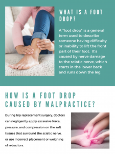 foot drop malpractice
